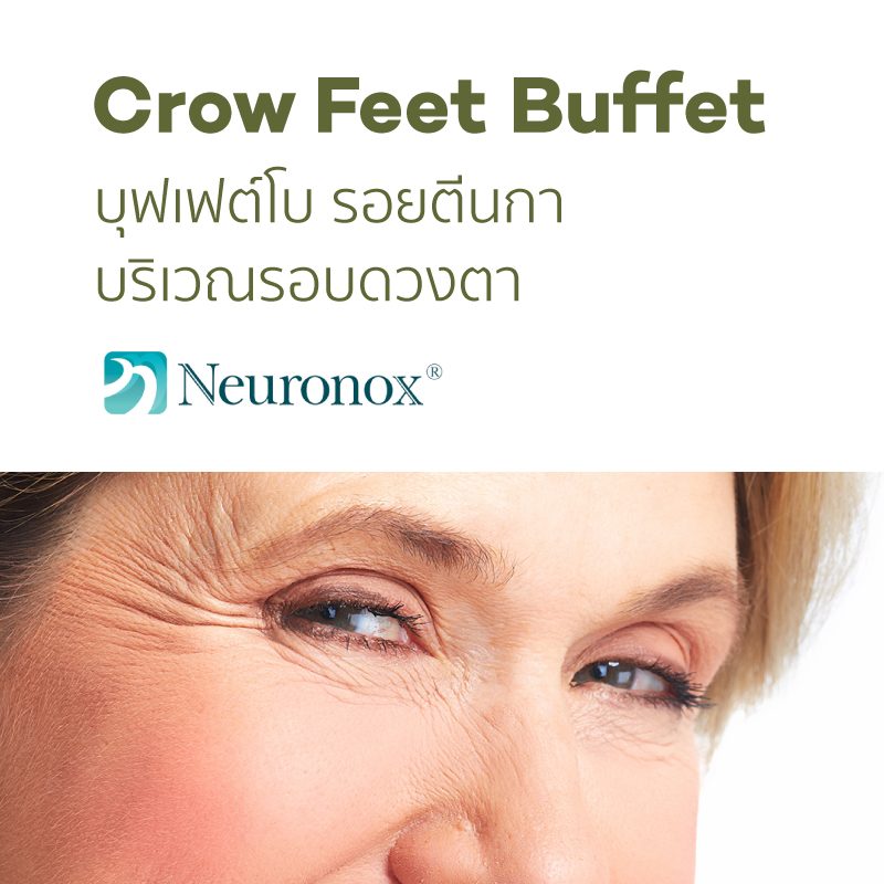 CC_services_Botox_Buffet_CrowFeet