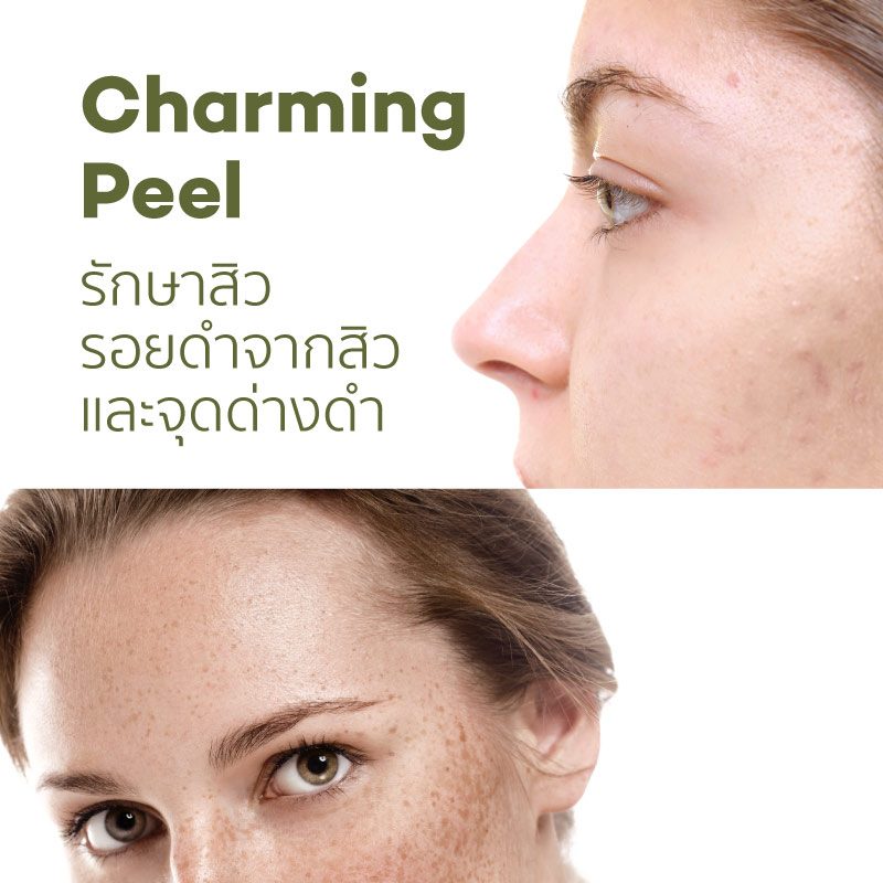 CC_services_CharmingPeel