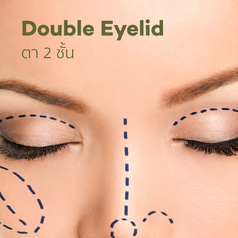 CC_services_Surgery_DoubleEyeLid