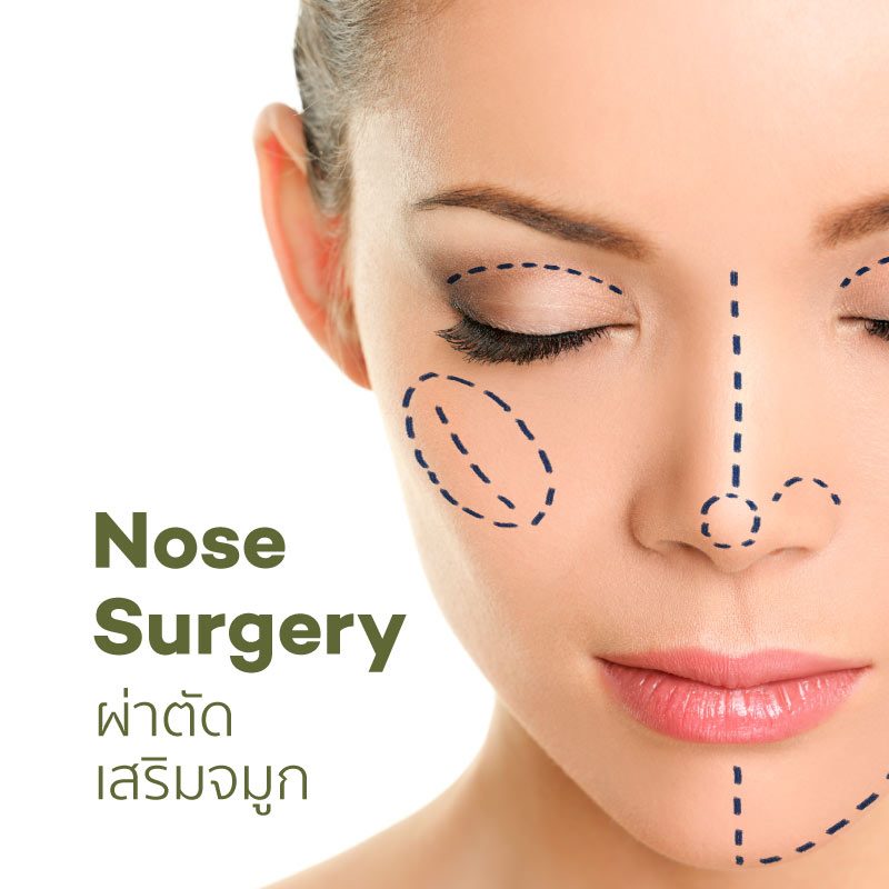 CC_services_Surgery_Nose