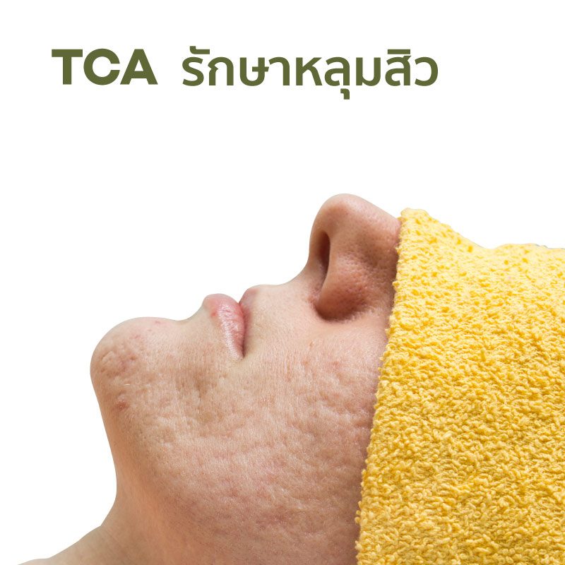 CC_services_TCA